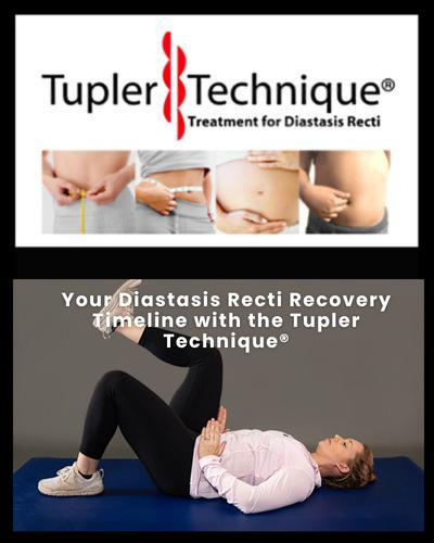 Your Diastasis Recti Recovery Timeline with the Tupler Technique - Diastasis Rehab