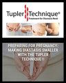 Preparing for Pregnancy: Making Diastasis Smaller with the Tupler Technique®