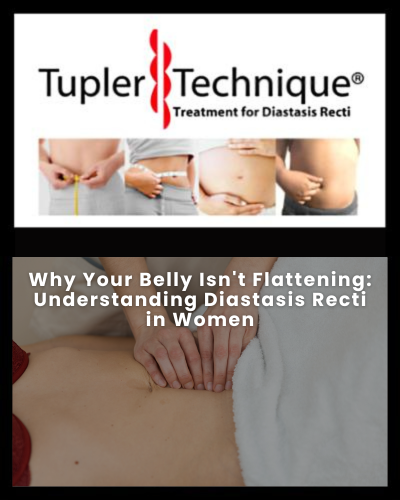 Why Your Belly Isn't Flattening: Understanding Diastasis Recti in Women