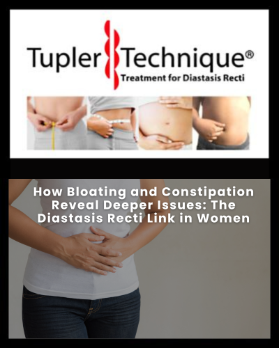 How Bloating and Constipation Reveal Deeper Issues: The Diastasis Recti Link in Women
