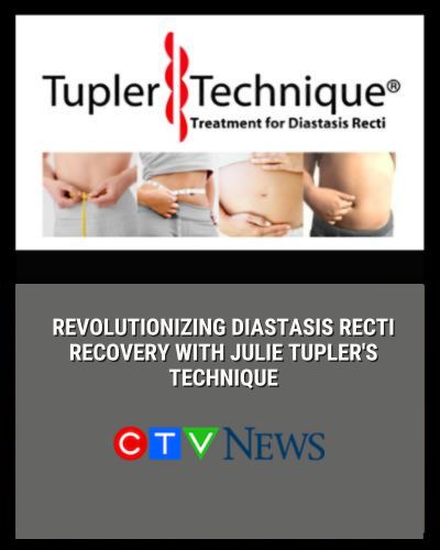 Julie Tupler, RN featured in CTV News 'Calls for more awareness on Diastasis recti by patients'-diastasisrehab