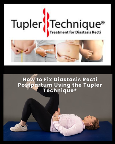 How to Fix Diastasis Recti Postpartum Using the Tupler Technique