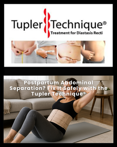 Postpartum Abdominal Separation - Diastasis Rehab