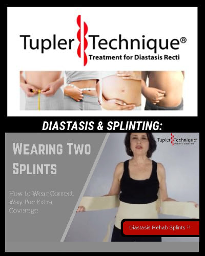 DIASTASIS & SPLINTING: Wearing Two Splints with Julie Tupler, RN
