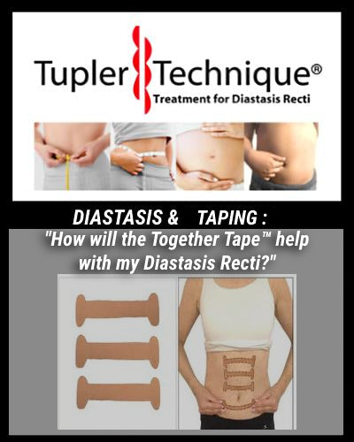 Together Tape™ for Diastasis Recti Healing | Non-Surgical Solution