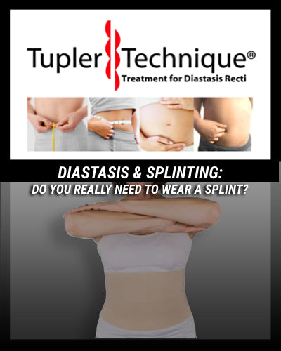 Do You Really Need To Wear a Splint To Heal Your Diastasis?