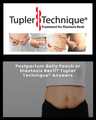 Postpartum Belly Pooch or Diastasis Recti? Tupler Technique® Answers