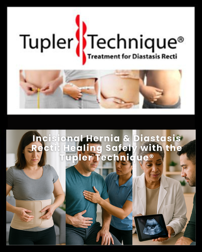Healing Safely with the Tupler Technique - Diastasis Rehab