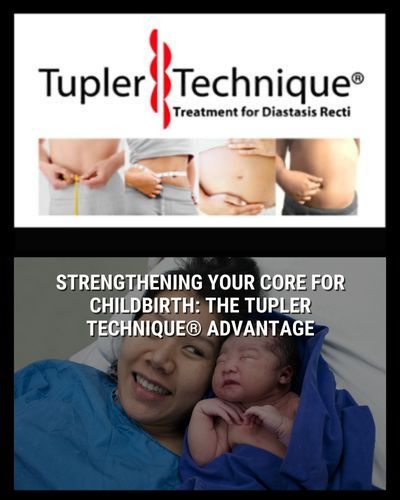 Strengthening Your Core for Childbirth: The Tupler Technique® Advantage