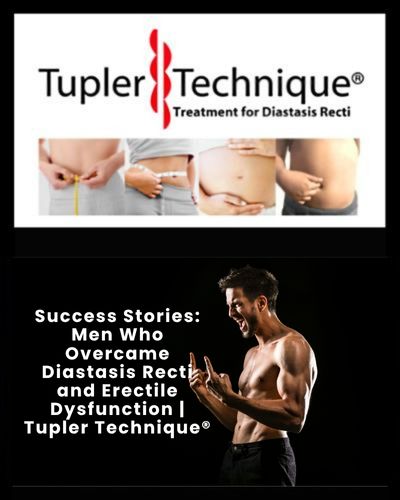 Success Stories: Men Who Overcame Diastasis Recti and Erectile Dysfunction | Tupler Technique®