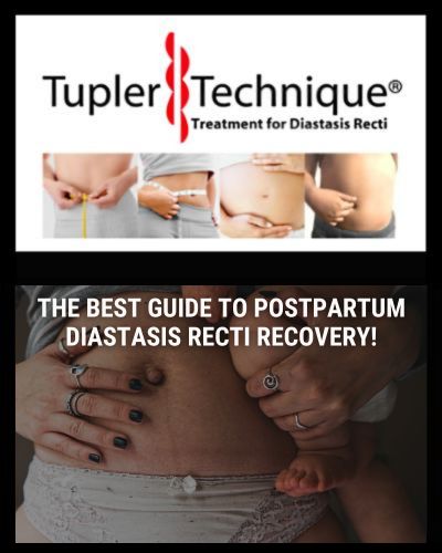 The Best Guide to Postpartum Diastasis Recti Recovery!