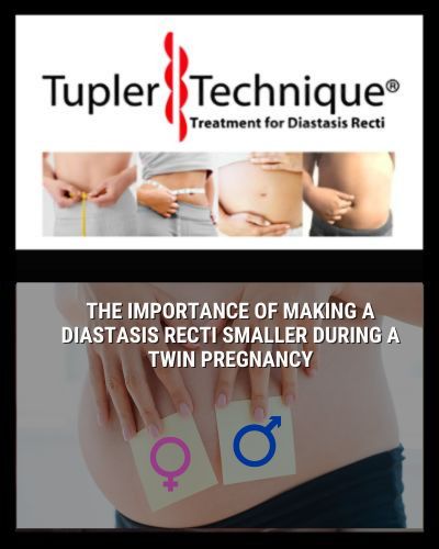 The Importance of Making a Diastasis Recti Smaller During a Twin Pregnancy