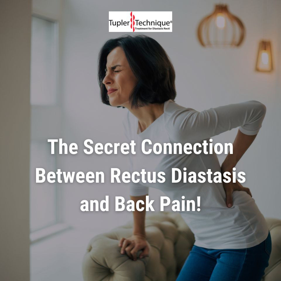 The Secret Connection Between Rectus Diastasis and Back Pain!