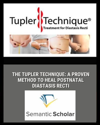 The Tupler Technique: A Proven Method to Heal Postnatal Diastasis Recti