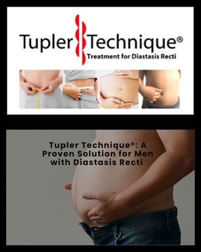 Tupler Technique: A Proven Solution for Men with Diastasis Recti - Diastasis Rehab