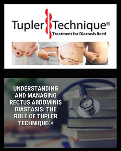 Understanding and Managing Rectus Abdominis Diastasis: The Role of Tupler Technique®