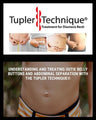 Understanding and Treating Outie Belly Buttons and Abdominal Separation with the Tupler Technique®