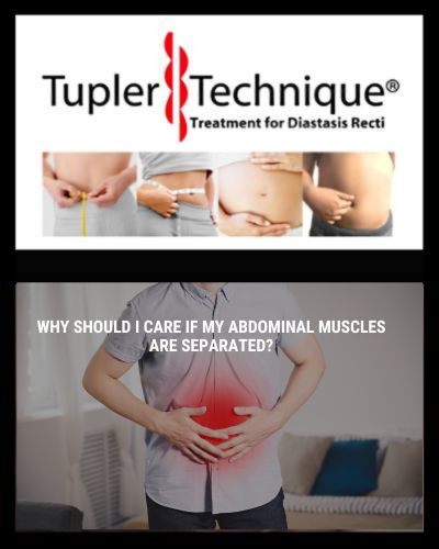 WHY SHOULD I CARE IF MY ABDOMINAL MUSCLES ARE SEPARATED?