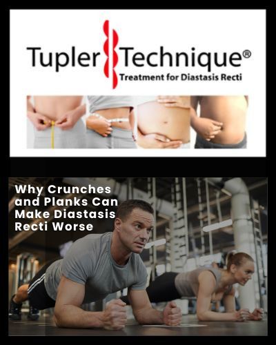 Why Crunches and Planks Can Make Diastasis Recti Worse