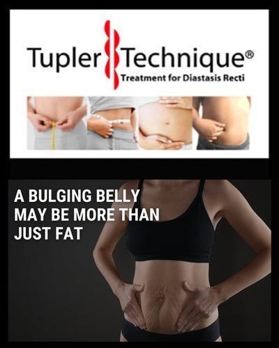 A Bulging Belly May Be More Than Just Fat - diastasisrehab