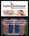 Addressing Severe Diastasis Recti: A Comprehensive Guide by The Tupler Technique®