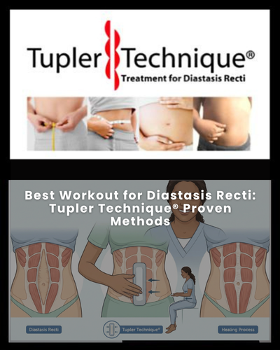 Best Workout for Diastasis Recti: Tupler Technique® Proven Methods
