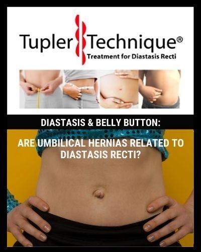 ARE UMBILICAL HERNIAS RELATED TO DIASTASIS RECTI?