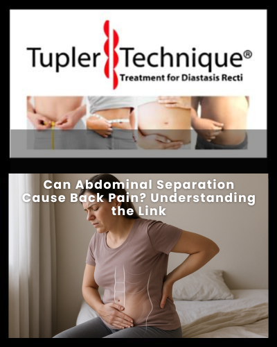 Can Abdominal Separation Cause Back Pain - Diastasis Rehab