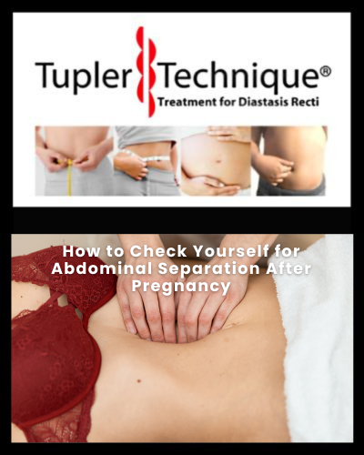 How to Check Yourself for Abdominal Separation After Pregnancy
