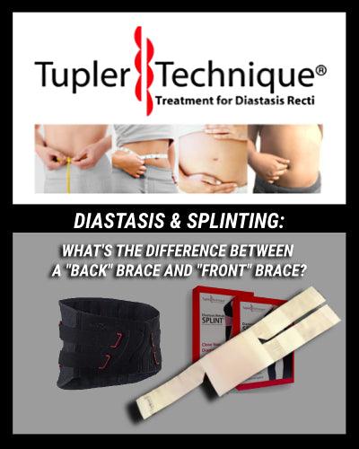 Back or Front Brace? Choosing the Right Support for Your Diastasis Recti - diastasisrehab