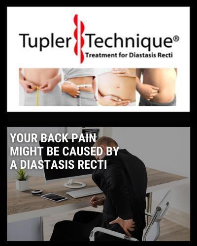 Back Pain and Diastasis Recti - diastasisrehab