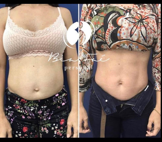 Bellies from Brazil - diastasisrehab