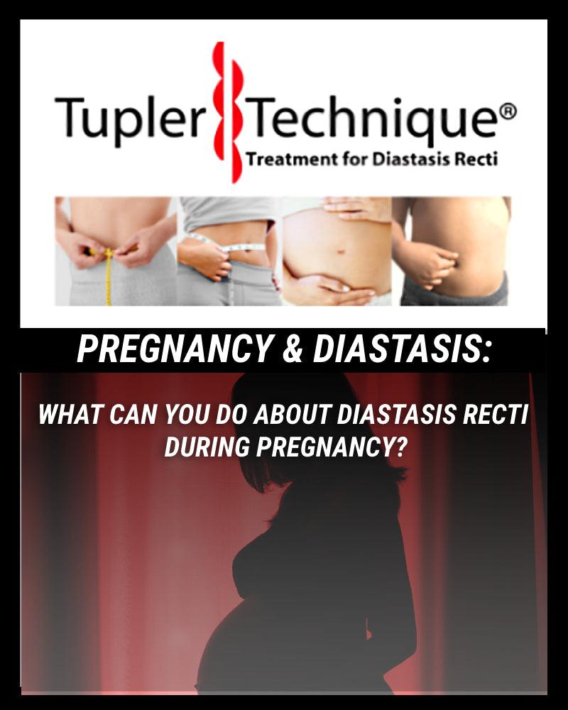 Can You Do Anything About Diastasis Recti During Pregnancy?