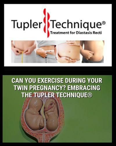 Can You Exercise During Your Twin Pregnancy? Embracing the Tupler Technique® - diastasisrehab