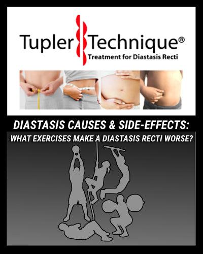 Closing Diastasis Recti: Healing Connective Tissue and Diastasis-Safe Workouts - diastasisrehab