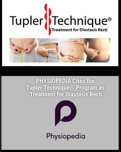 Comprehensive Tupler Technique® for All: Healing Diastasis Recti Across Ages and Genders - diastasisrehab