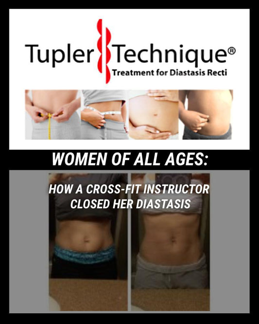 Cross-Fit Instructor Shares Best Tips On How She Closed Her Diastasis - diastasisrehab