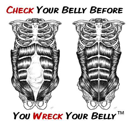 Check Your Belly Before You Wreck Your Belly - Diastasis Rehab