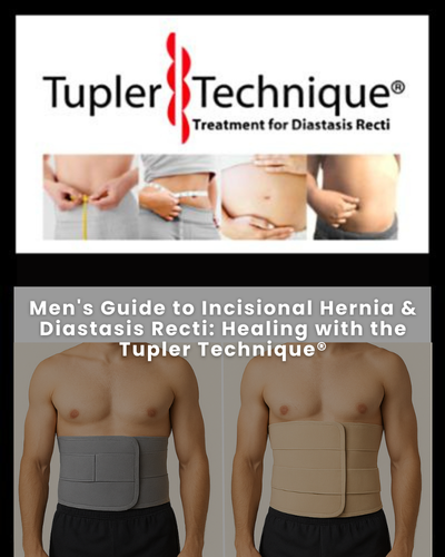 Men's Guide to Incisional Hernia & Diastasis Recti: Healing with the Tupler Technique
