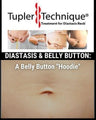 DIASTASIS & BELLY BUTTON:  A Belly Button 