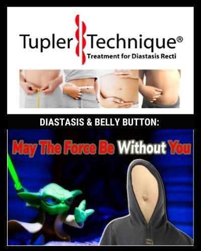 DIASTASIS & BELLY BUTTON: Beware of the "Dark Side of the Force" on your Diastasis - diastasisrehab