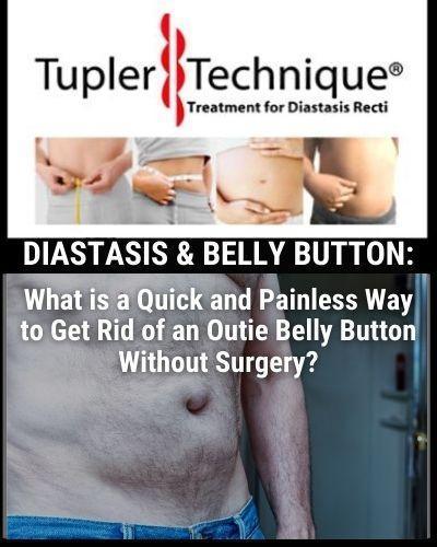 DIASTASIS & BELLY BUTTON: What is a Quick and Painless Way to Get Rid of an Outie Belly Button Without Surgery? - diastasisrehab