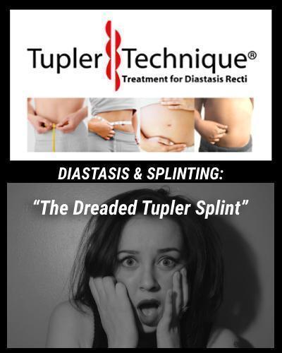 DIASTASIS & SPLINTING: “The Dreaded Tupler Splint” - diastasisrehab