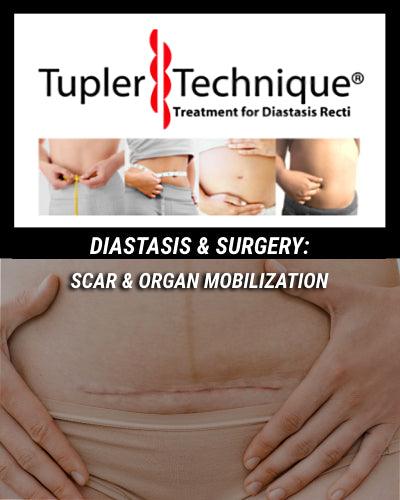 DIASTASIS & SURGERY: Scar & Organ Mobilization - diastasisrehab
