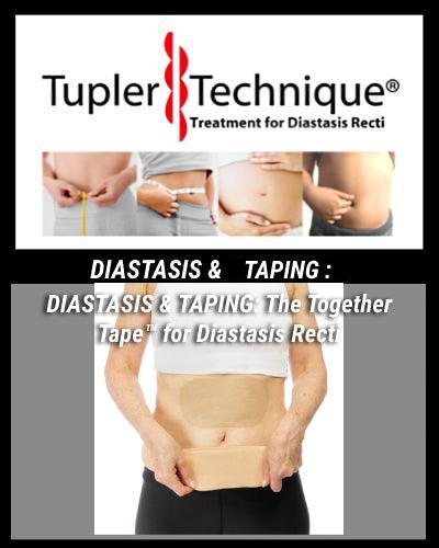 DIASTASIS & TAPING: The Together Tape™ for Diastasis Recti - diastasisrehab