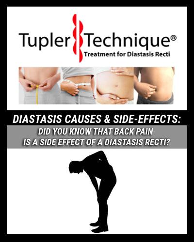 Diastasis Recti & Back Pain: Uncover the Surprising Connection! - diastasisrehab