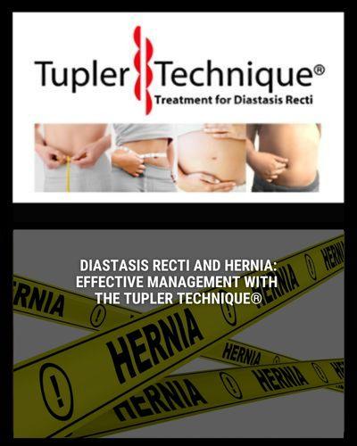 Diastasis Recti and Hernia: Effective Management with the Tupler Technique® - diastasisrehab
