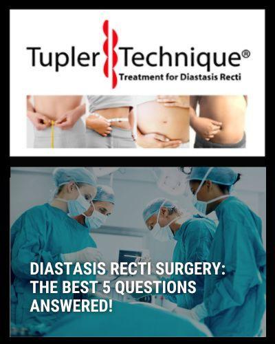 Diastasis Recti Surgery: The Best 5 Questions Answered! - diastasisrehab