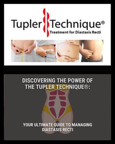 Discovering the Power of the Tupler Technique®: Your Ultimate Guide to Managing Diastasis Recti - diastasisrehab