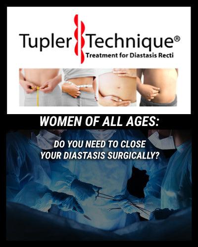 Do You Need To Close Your Diastasis Surgically? - diastasisrehab